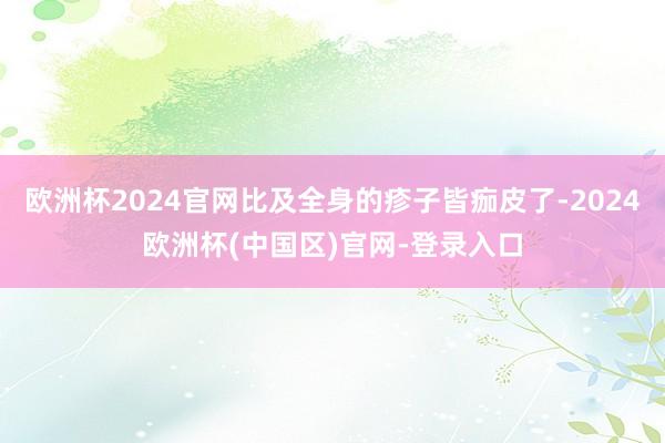 欧洲杯2024官网比及全身的疹子皆痂皮了-2024欧洲杯(中国区)官网-登录入口